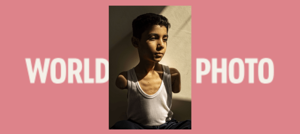 World Press Photo premia imagen de niño víctima del genocidio sionista en Palestina