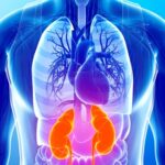 Síndrome que daña corazón, riñones y metabolismo va en aumento: expertos